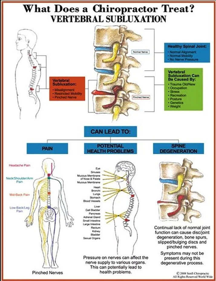 Chiropractic Palm Desert CA Vertebral Subluxations